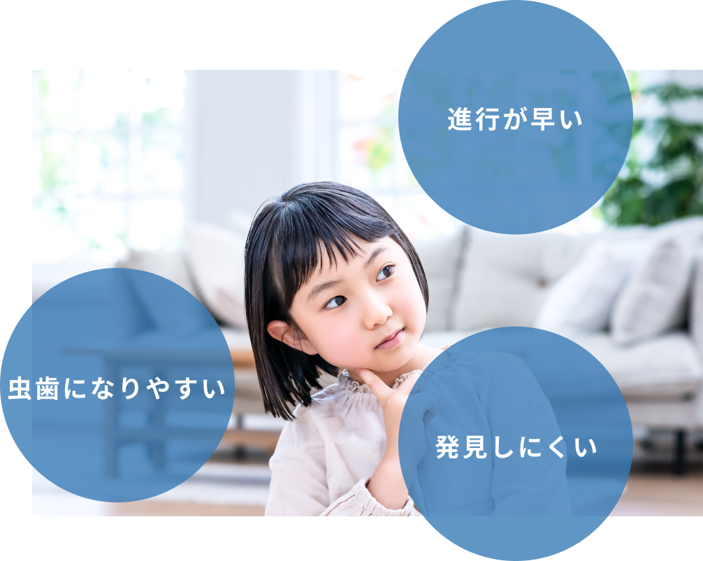 乳歯の虫歯の特徴