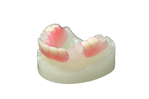 ノンクラスプデンチャー