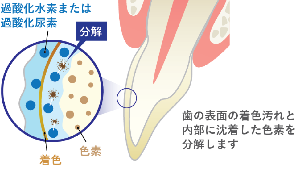 ホワイトニング剤